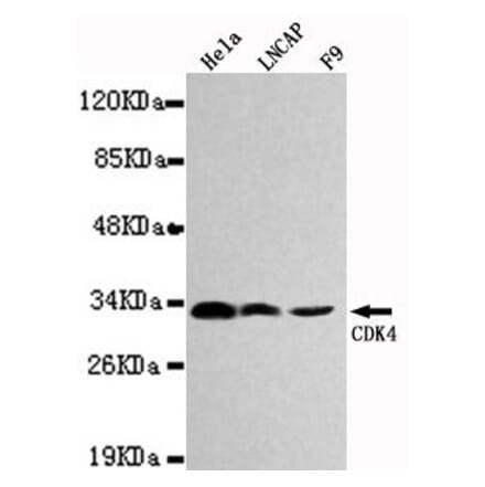 Anti-CDK4 Antibody from Bioworld Technology (MB0027) - Antibodies.com