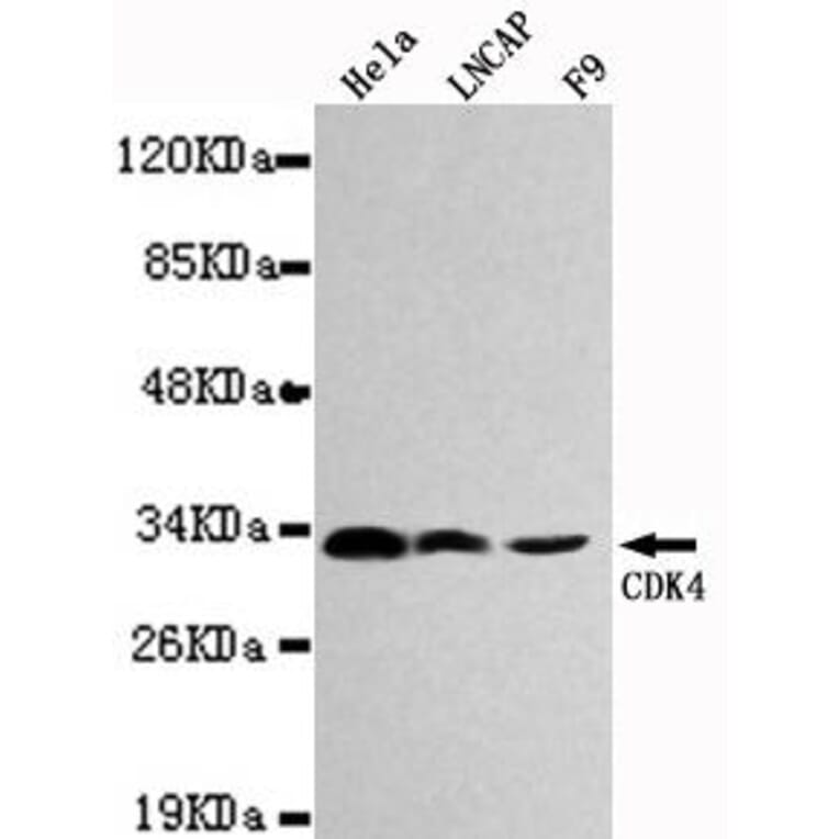 Anti-CDK4 Antibody from Bioworld Technology (MB0027) - Antibodies.com