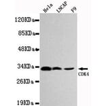 Anti-CDK4 Antibody from Bioworld Technology (MB0027) - Antibodies.com