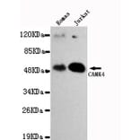 Anti-CAMKIV Antibody from Bioworld Technology (MB0028) - Antibodies.com