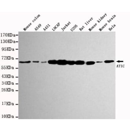 Anti-ATIC Antibody from Bioworld Technology (MB0029) - Antibodies.com