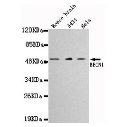 Anti-Beclin 1 Antibody from Bioworld Technology (MB0030) - Antibodies.com