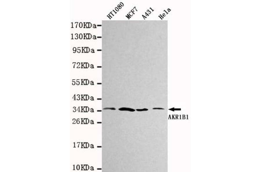 Anti-AKR1B1 Antibody from Bioworld Technology (MB0032) - Antibodies.com