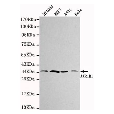 Anti-AKR1B1 Antibody from Bioworld Technology (MB0032) - Antibodies.com