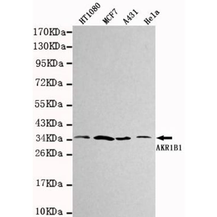 Anti-AKR1B1 Antibody from Bioworld Technology (MB0032) - Antibodies.com