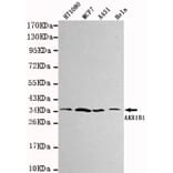 Anti-AKR1B1 Antibody from Bioworld Technology (MB0032) - Antibodies.com