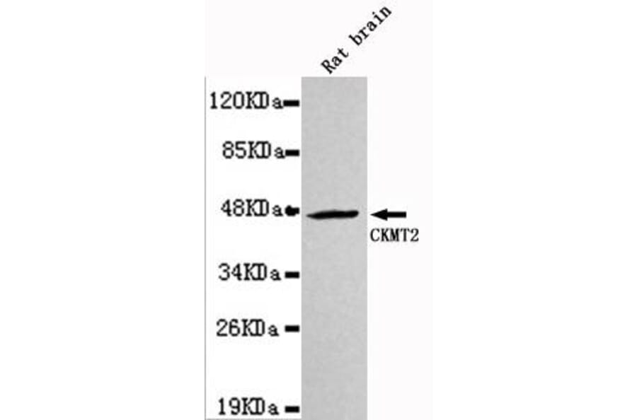Anti-CKMT2 Antibody from Bioworld Technology (MB0033) - Antibodies.com