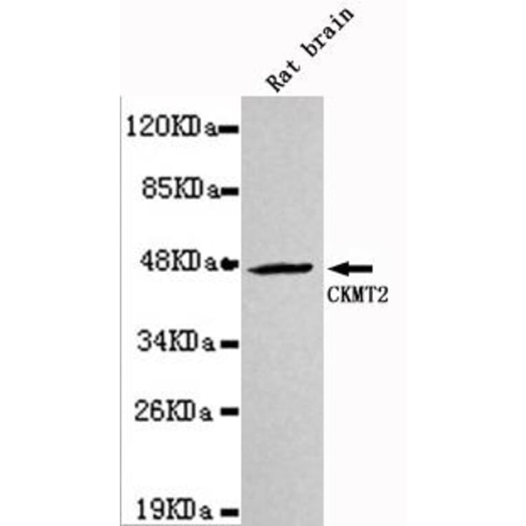 Anti-CKMT2 Antibody from Bioworld Technology (MB0033) - Antibodies.com