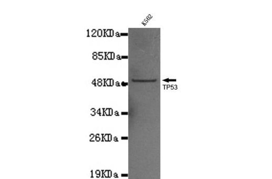 Anti-p53 (C-terminus) Antibody from Bioworld Technology (MB0038) - Antibodies.com