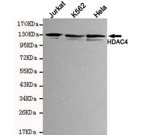 Anti-HDAC4 (N-terminus) Antibody from Bioworld Technology (MB0041) - Antibodies.com