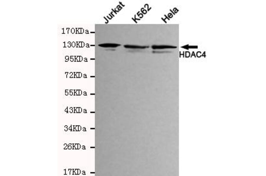 Anti-HDAC4 (N-terminus) Antibody from Bioworld Technology (MB0041) - Antibodies.com