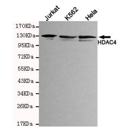Anti-HDAC4 (N-terminus) Antibody from Bioworld Technology (MB0041) - Antibodies.com