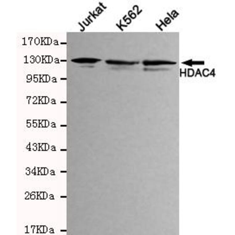 Anti-HDAC4 (N-terminus) Antibody from Bioworld Technology (MB0041) - Antibodies.com