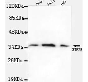 Anti-TFIIB Antibody from Bioworld Technology (MB0045) - Antibodies.com