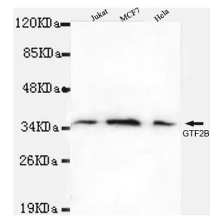 Anti-TFIIB Antibody from Bioworld Technology (MB0045) - Antibodies.com