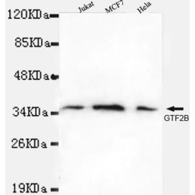 Anti-TFIIB Antibody from Bioworld Technology (MB0045) - Antibodies.com