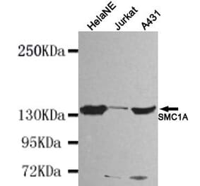 Anti-SMC1A (N-terminus) Antibody from Bioworld Technology (MB0047) - Antibodies.com