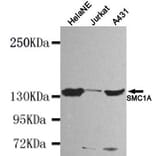 Anti-SMC1A (N-terminus) Antibody from Bioworld Technology (MB0047) - Antibodies.com