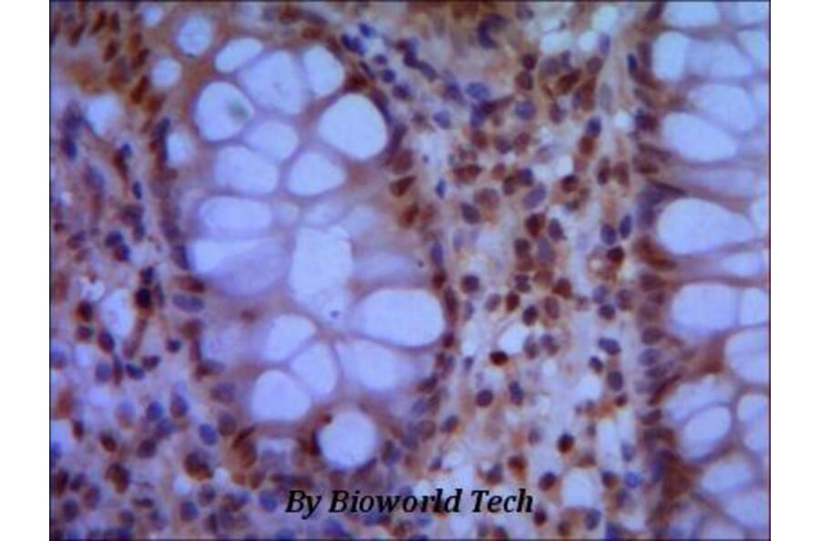 Anti-SMC1A (N-terminus) Antibody from Bioworld Technology (MB0047) - Antibodies.com