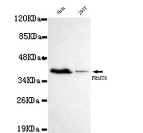 Anti-PRMT6 Antibody from Bioworld Technology (MB0049) - Antibodies.com