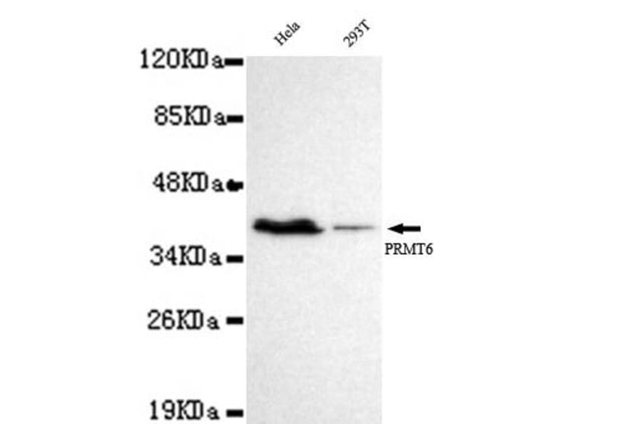 Anti-PRMT6 Antibody from Bioworld Technology (MB0049) - Antibodies.com