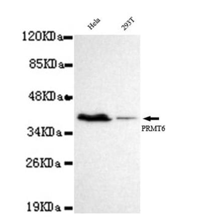Anti-PRMT6 Antibody from Bioworld Technology (MB0049) - Antibodies.com