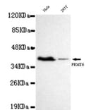 Anti-PRMT6 Antibody from Bioworld Technology (MB0049) - Antibodies.com