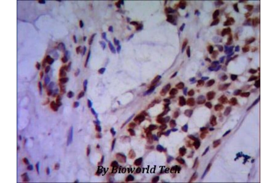 Anti-PRMT6 Antibody from Bioworld Technology (MB0049) - Antibodies.com