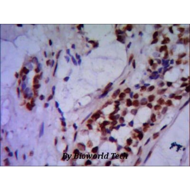 Anti-PRMT6 Antibody from Bioworld Technology (MB0049) - Antibodies.com