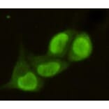 Anti-PRMT6 Antibody from Bioworld Technology (MB0049) - Antibodies.com