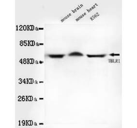 Anti-TBLR1 Antibody from Bioworld Technology (MB0051) - Antibodies.com