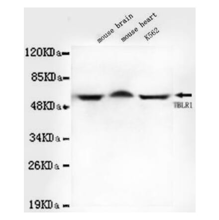 Anti-TBLR1 Antibody from Bioworld Technology (MB0051) - Antibodies.com