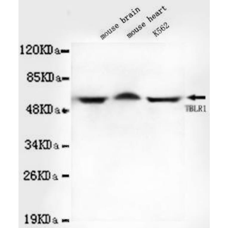 Anti-TBLR1 Antibody from Bioworld Technology (MB0051) - Antibodies.com