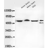 Anti-TBLR1 Antibody from Bioworld Technology (MB0051) - Antibodies.com