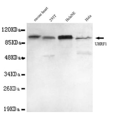 Anti-UHRF1 (N-terminus) Antibody from Bioworld Technology (MB0055) - Antibodies.com
