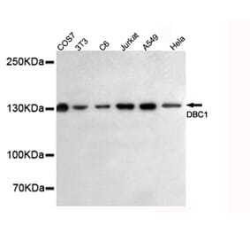 Anti-DBC1 (3G4) Antibody from Bioworld Technology (MB0057) - Antibodies.com