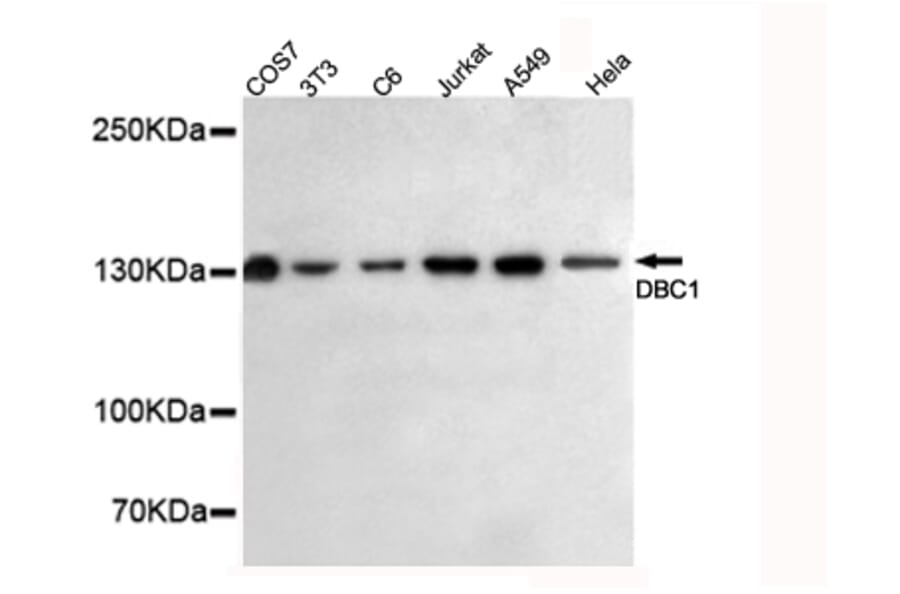 Anti-DBC1 (3G4) Antibody from Bioworld Technology (MB0057) - Antibodies.com