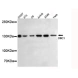 Anti-DBC1 (3G4) Antibody from Bioworld Technology (MB0057) - Antibodies.com