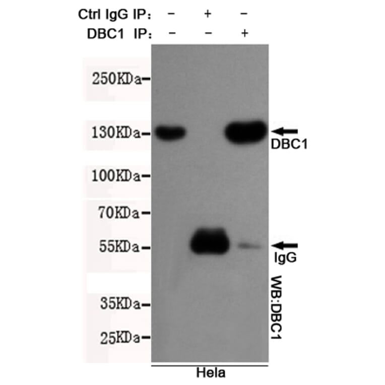 Anti-DBC1 (3G4) Antibody from Bioworld Technology (MB0057) - Antibodies.com