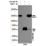 Anti-DBC1 (3G4) Antibody from Bioworld Technology (MB0057) - Antibodies.com