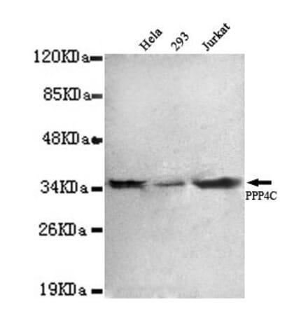 Anti-PPP4C Antibody from Bioworld Technology (MB0060) - Antibodies.com