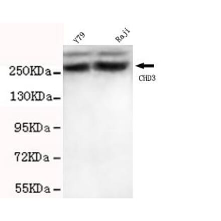 Anti-CHD3 (C-terminus) Antibody from Bioworld Technology (MB0061) - Antibodies.com