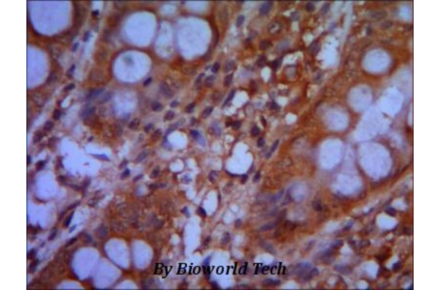 Anti-CHD3 (C-terminus) Antibody from Bioworld Technology (MB0061) - Antibodies.com
