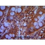Anti-CHD3 (C-terminus) Antibody from Bioworld Technology (MB0061) - Antibodies.com
