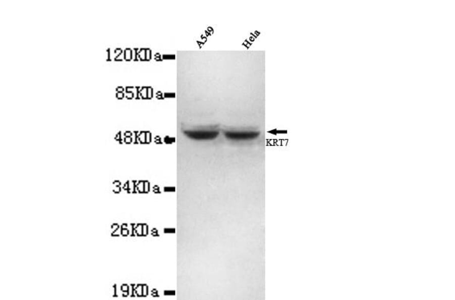 Anti-Cytokeratin 7 (N-terminus) Antibody from Bioworld Technology (MB0062) - Antibodies.com