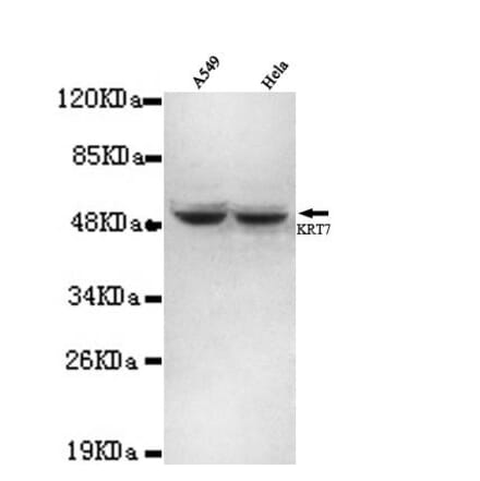 Anti-Cytokeratin 7 (N-terminus) Antibody from Bioworld Technology (MB0062) - Antibodies.com