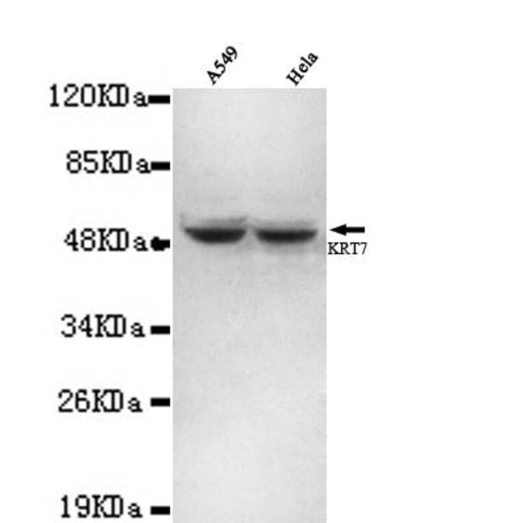 Anti-Cytokeratin 7 (N-terminus) Antibody from Bioworld Technology (MB0062) - Antibodies.com