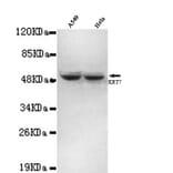 Anti-Cytokeratin 7 (N-terminus) Antibody from Bioworld Technology (MB0062) - Antibodies.com