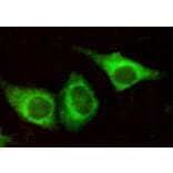 Anti-Cytokeratin 7 (N-terminus) Antibody from Bioworld Technology (MB0062) - Antibodies.com
