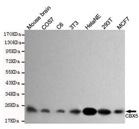Anti-CBX5 Antibody from Bioworld Technology (MB0063) - Antibodies.com